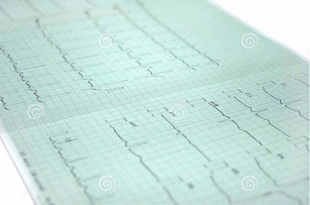 Electrocardiograma